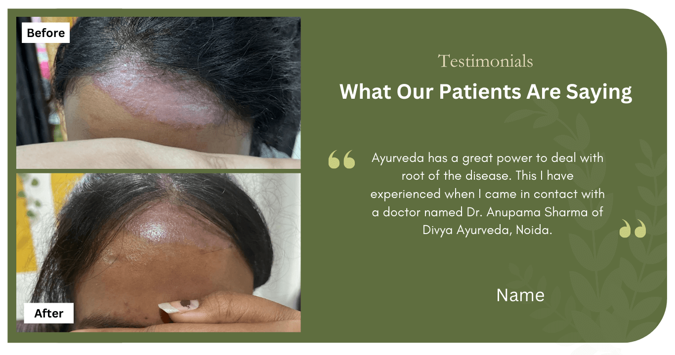 patient-testimonial-aayurvedic-treatment