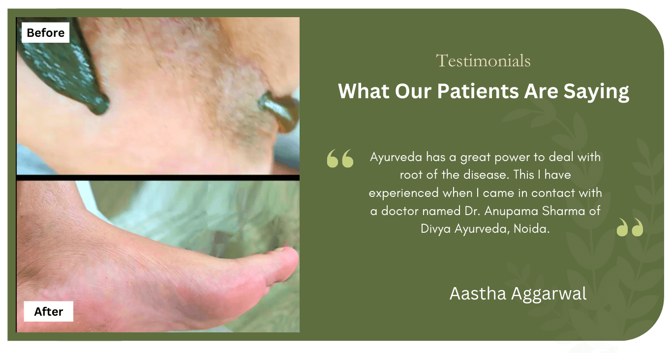 patient-testimonials-aastha-aggarwal